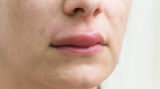 Why Is My Lip Swollen For No Reason : 6 Common Causes